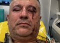 Activistul Tiberiu Boșutar și doi jurnaliști, bătuți în timp ce filmau un documentar despre tăierile ilegale de păduri