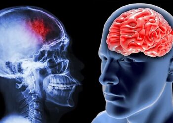 Consumul de grăsimi vegetale scade riscul de accident vascular cerebral